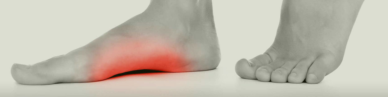 Piedi